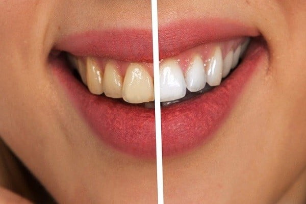 How-to-remove-coffee-stains-from-teeth